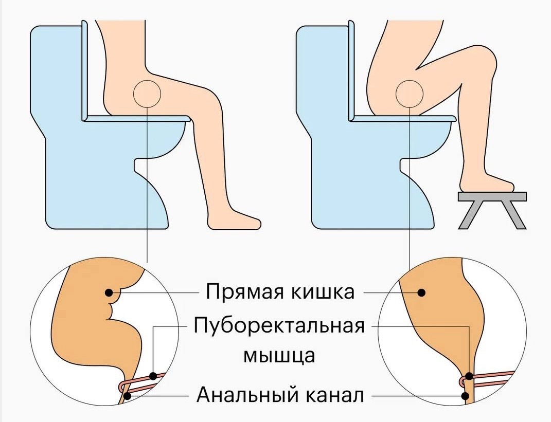 Туалетные привычки для здоровья тазового дна и мочевого пузыря