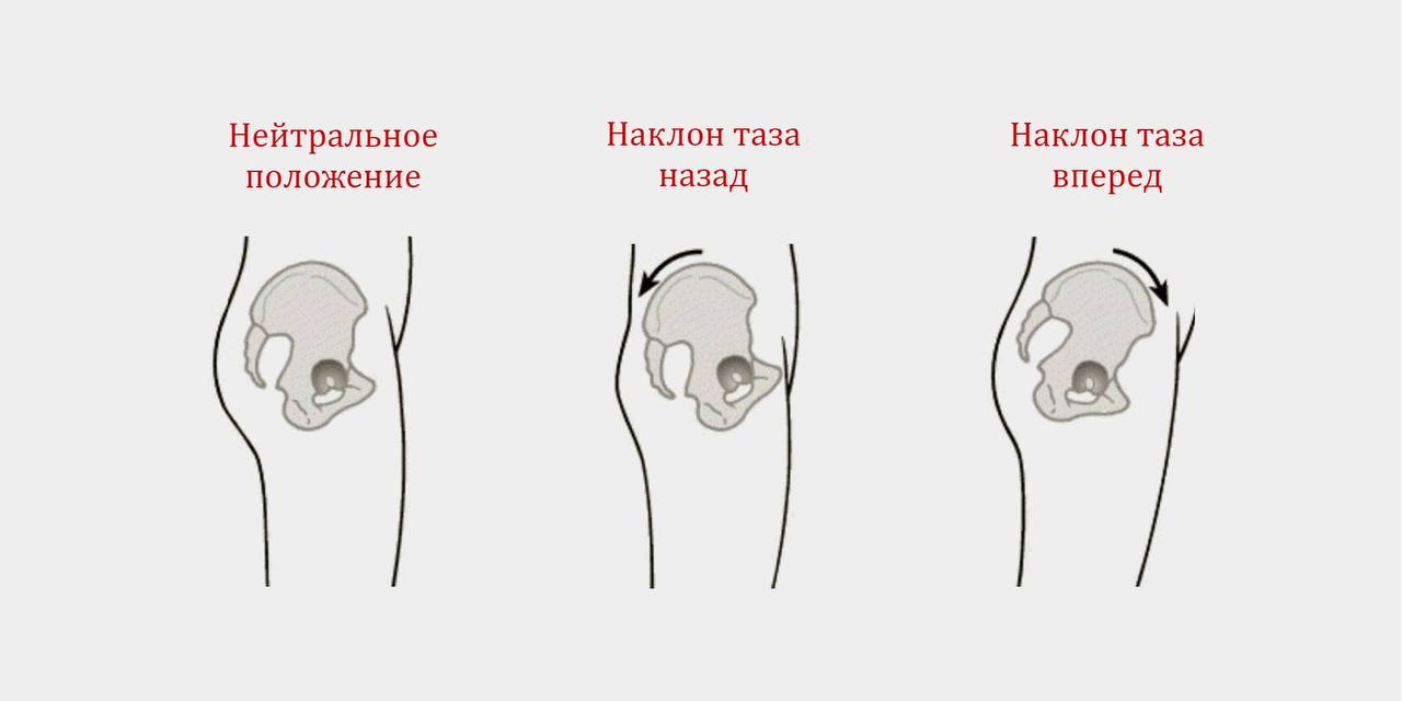 Поза мышечной поддержки
