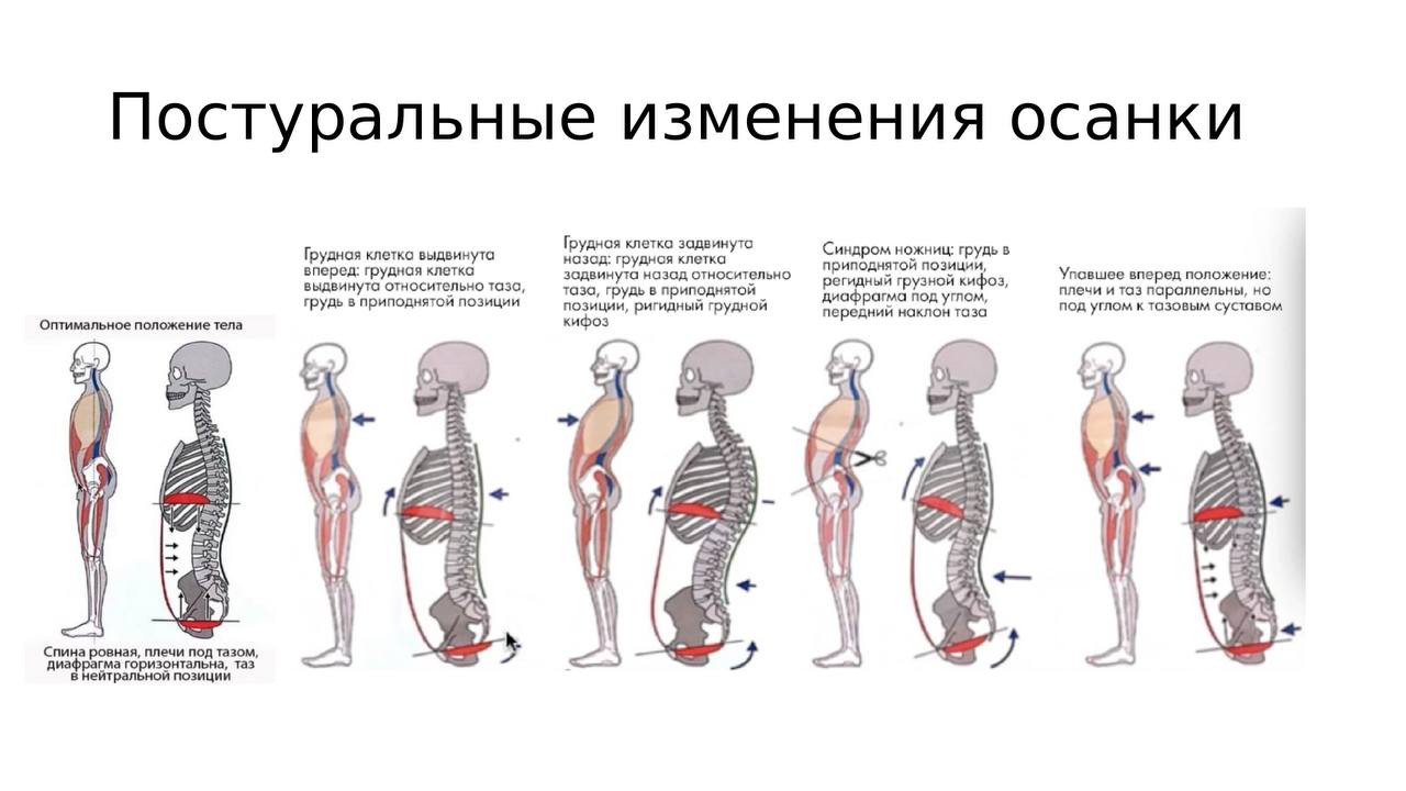 Поза мышечной поддержки, вид сбоку