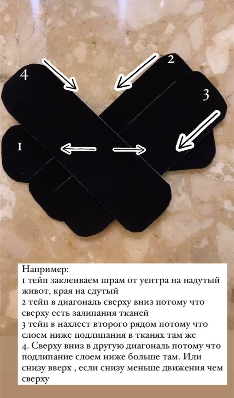 Тейпирование шрамов