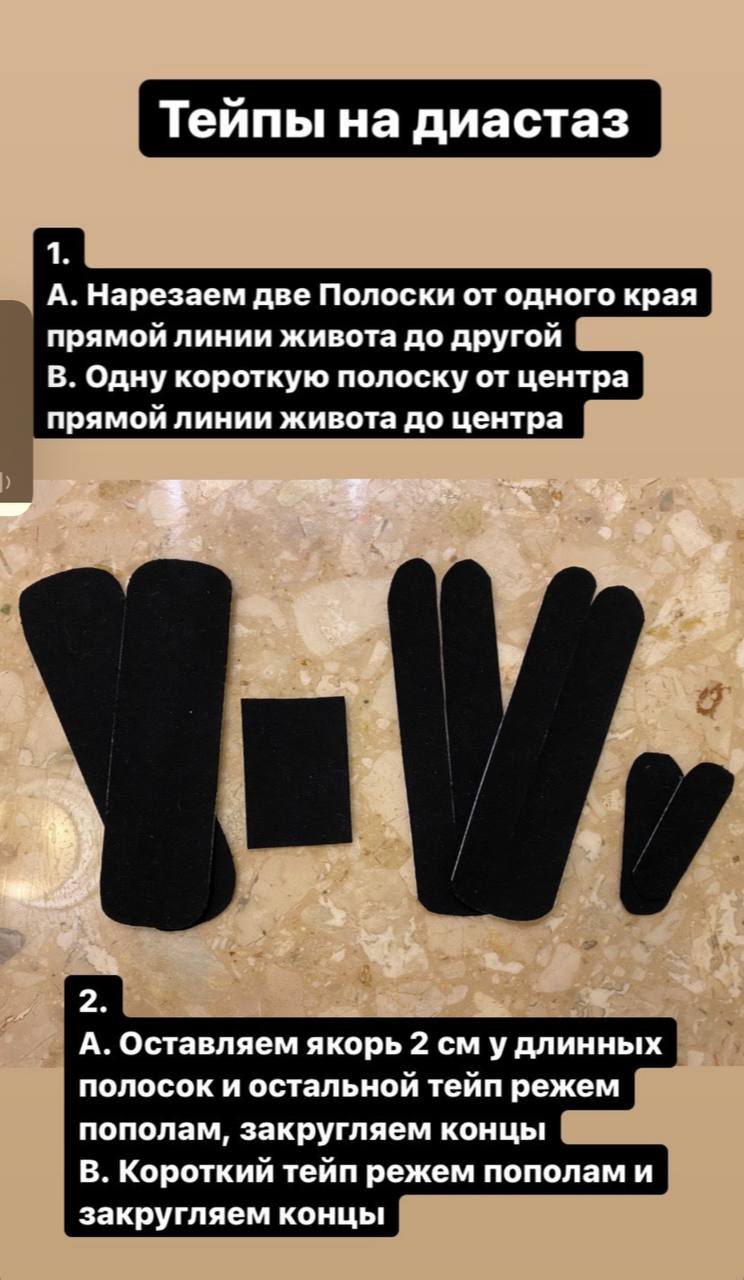 Тейпирование диастаза