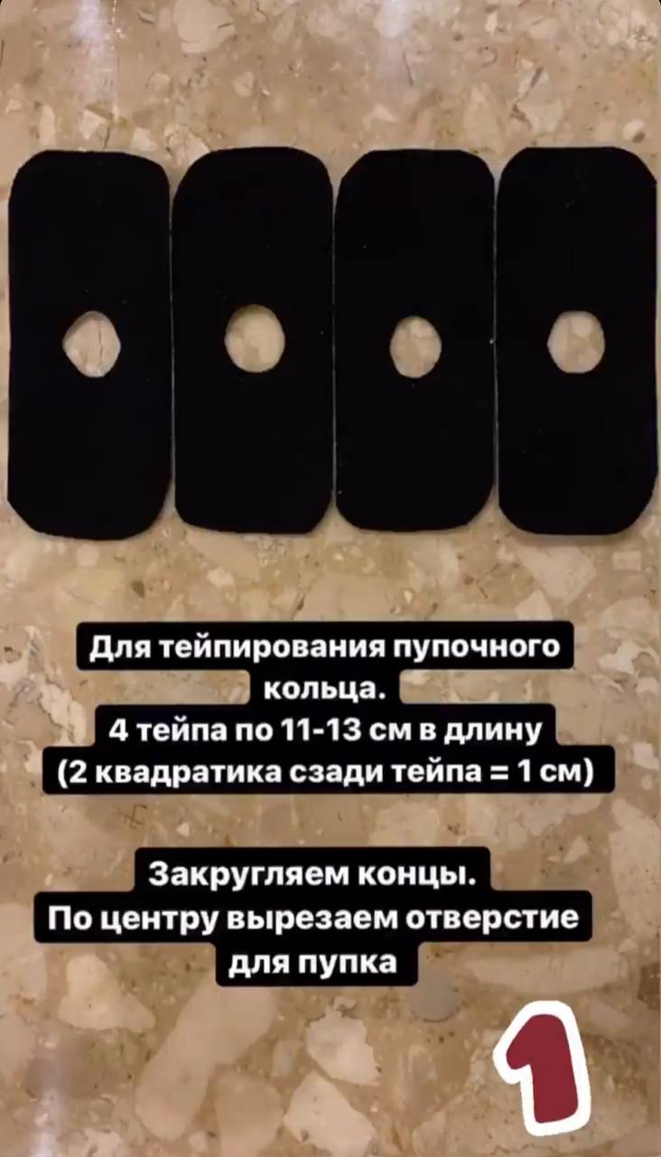 Тейпирование: Пупочное кольцо