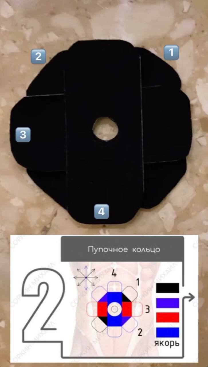 Тейпирование: Пупочное кольцо